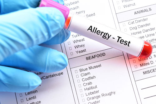 allergy testing